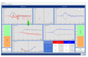 Video Head Impulse Test (VHIT)